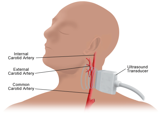 Cardiologist in Houston | Dr. Zacca Treats Heart Patients