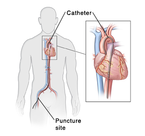 Cardiologist in Houston