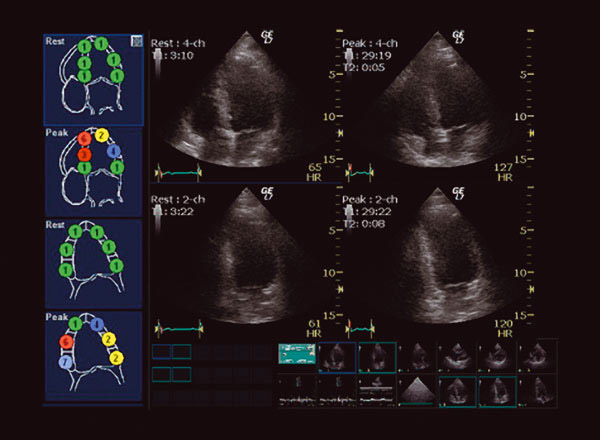 Cardiologist in Houston | Dr. Zacca Treats Heart Patients